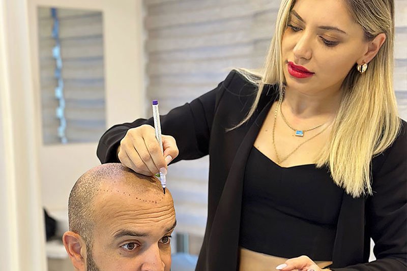 Uzman Doktor Kontrolünde Sedasyonlu Saç Ekimi